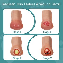 MedEduQuest Heel Pressure Injury Stages Model, Ulcer Demonstration Model