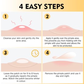 KAMLO Acne Patches - 72 pack hydrocolloid patches for all skin types - gentle and natural, clear and smooth skin.