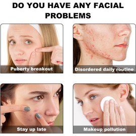 200 Parches Hidrocoloides para Espinillas y Acné, Forma de Estrella, Absorbe Secreciones, Reduce Inflamación y Marcas, Protege la Piel de Impurezas, Ideal para Uso Diario y Nocturno
