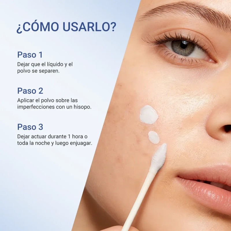 Leo Acne Buster Loción Secante Ácido Salicílico