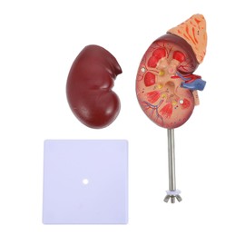 Kisangel Kidney Dissection Model Anatomical Display for Biology Education Teaching Prop for High School and Medical Students Detachable Design with Stand for Easy Viewing
