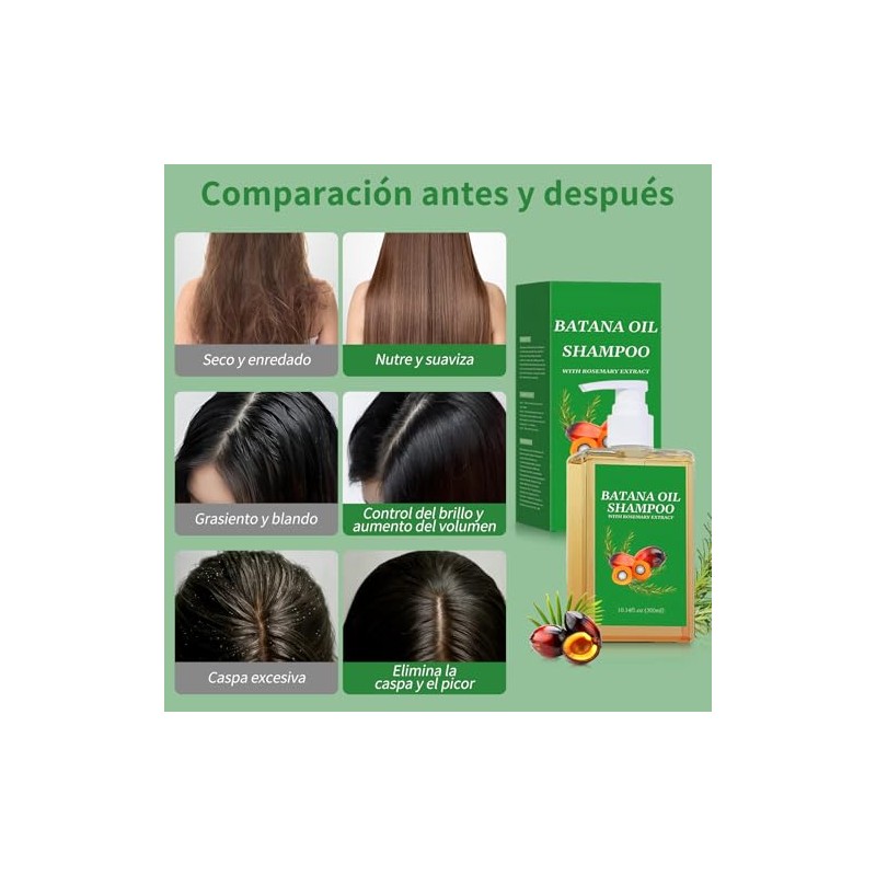 1PCS Shampoo Romero,Champú de Aceite Battana de 300 ml para
