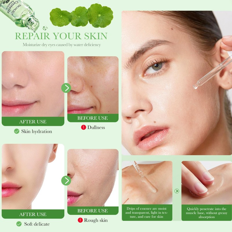 BIOAQUA Centella Asiatica Soothing Repair Facial Serum Nourish Oil Control