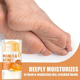 Intensive Honey Foot & Hand Cream for Dry, Cracked Skin – Moisturize Heels & Hands for Men & Women – 40g (40 Ml, 1pcs)