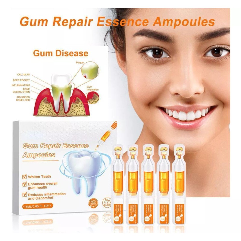 generic 14 Piezas De Gel Dental Para Restauración
