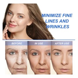 Suero Antienvejecimiento Iluminador Vitamina C Y Colágeno Momento De Aplicación Noche Tipo De Piel Mixta