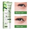 Crema Contorno Ojos Centella Asiática Antiojeras Antiarrugas Tipo De Piel