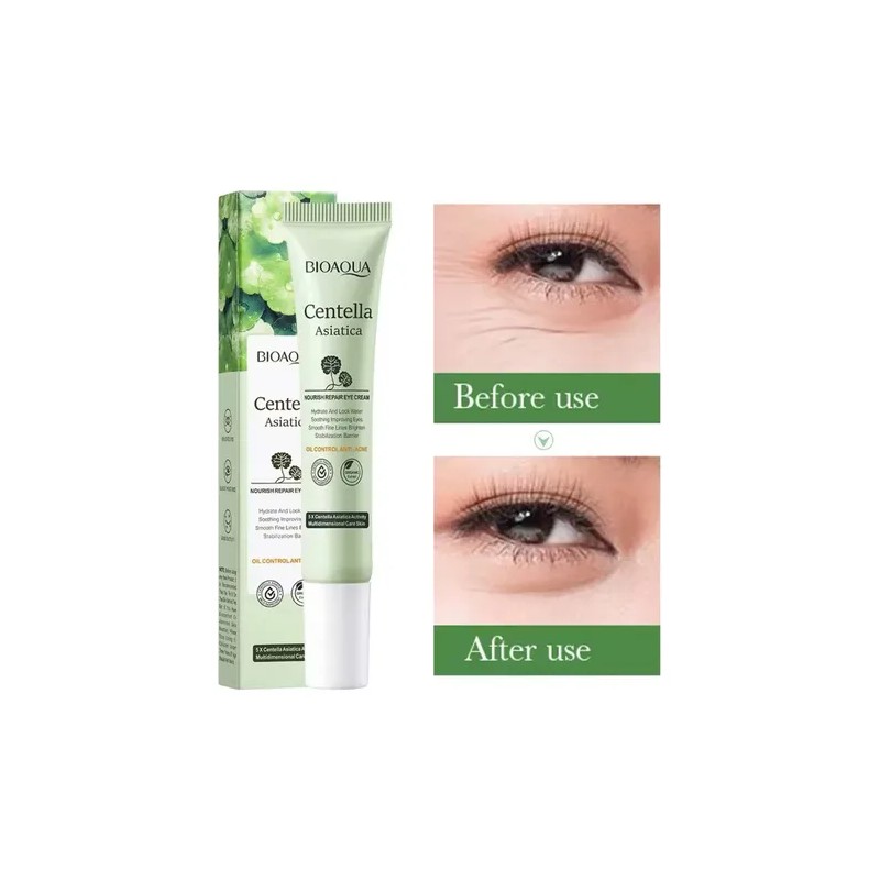 Crema Contorno Ojos Centella Asiática Antiojeras Antiarrugas Tipo De Piel