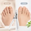 Large Jaw Toenail Clippers for Thick Nails – Stainless Steel