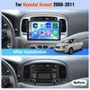 Realdio [4+64G] Car Stereo Radio for Hyundai Accent 2006 2007