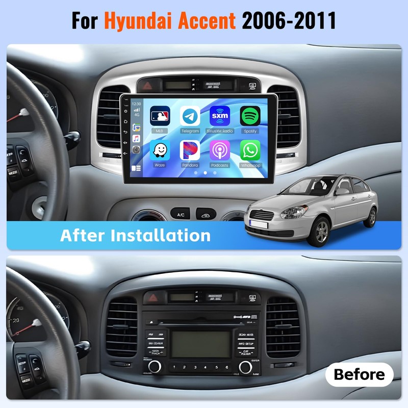 Realdio [4+64G] Car Stereo Radio for Hyundai Accent 2006 2007