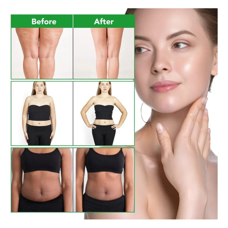 Aceite Anti-celulitis Masaje Reafirmante Con Colágeno 250ml Lavanda