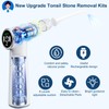 Tonsil Stone Remover Tool, Upgraded Electric Tonsil Stone Removal Kit