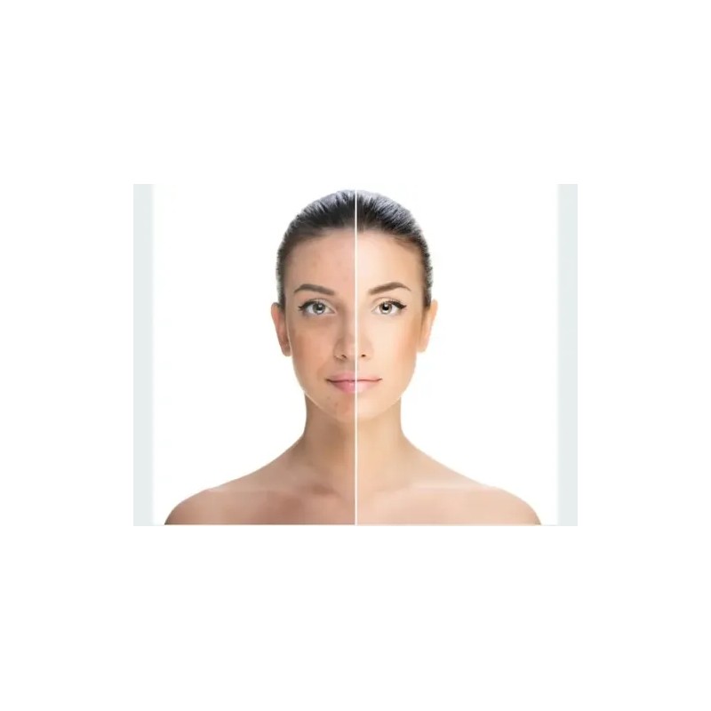 Emulsion 100%natural D Arroz Aclara Cutis Manchas Rejuvene