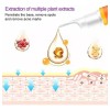 Tratamiento Serum Aclarante Manchas Paño Pecas Acne 30ml