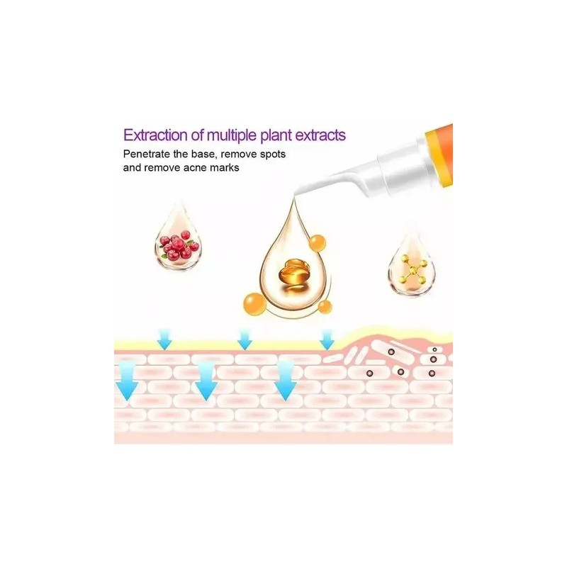 Tratamiento Serum Aclarante Manchas Paño Pecas Acne 30ml