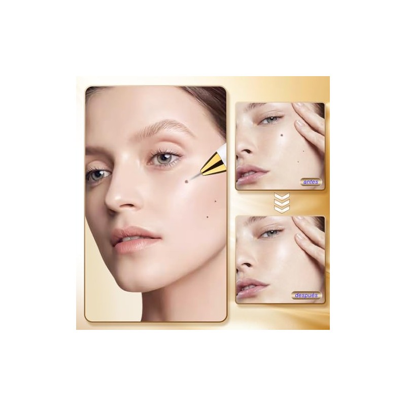 Plasma Pen Dispositivo de Belleza Para La Eliminación de Imperfecciones
