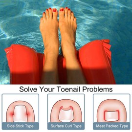 Eingewachsene Zehennägel Set,Ingrown Zehennagel Korrektur Set,50 Stück Schmerzfreie Zehennagelglättungsstreifen,Set zur Korrektur Eingewachsener Zehennägel,Zehennagel Korrektur Patch