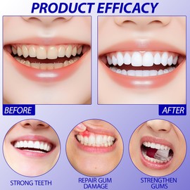 Guegine Gum Repair Gel 2 PCS Gum Relief Drops Gingival Repair Drops,Easy to Carry Freshen Breath and Effectively Relieve Gum Bleeding and Deep Cleaning Teeth (30ml)