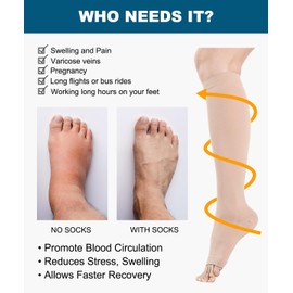 Open Toe Medical Compression Stockings Women & Men 20-30 mmHg Class 2, Size S-4XL, Compression Socks Support Stockings for Varicose Veins Edema Flight, beige