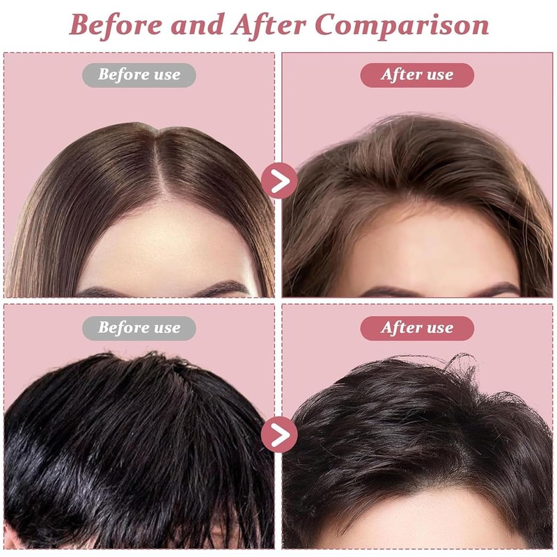 Volume Clip, Volume Clips Hair - Traceless Hair Root Clips