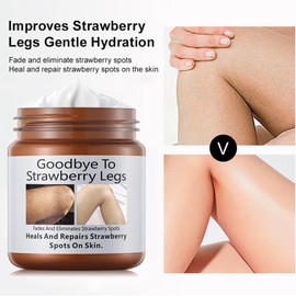 Strawberry Legs Treatment,Keratosis Pilaris Cream,Strawberry Skin Treatment,Skin Exfoliating Repair Cream,Moisturizing Body Cream,Rough Bumpy Skin Body Lotion(120g)