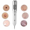 Household Face Mole Removal Pen Dark Spots Plaques Remover Skin