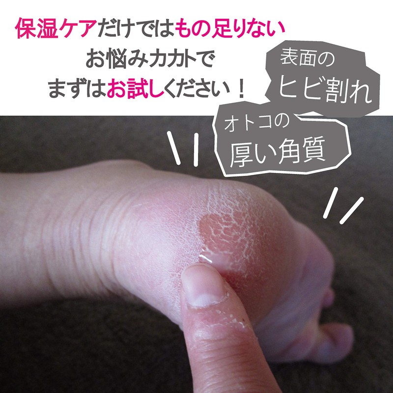 Perfect NAILS Foot File, Foot Care, File, Waterproof, Exfoliating, Exfoliating,