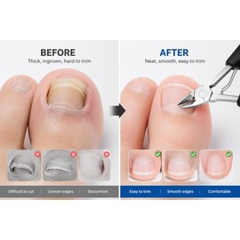 Ingrown Toenail Clippers for Thick & Hard Nails – Precision Eagle-Beak Curved Cutter for Easy Home Nail Care