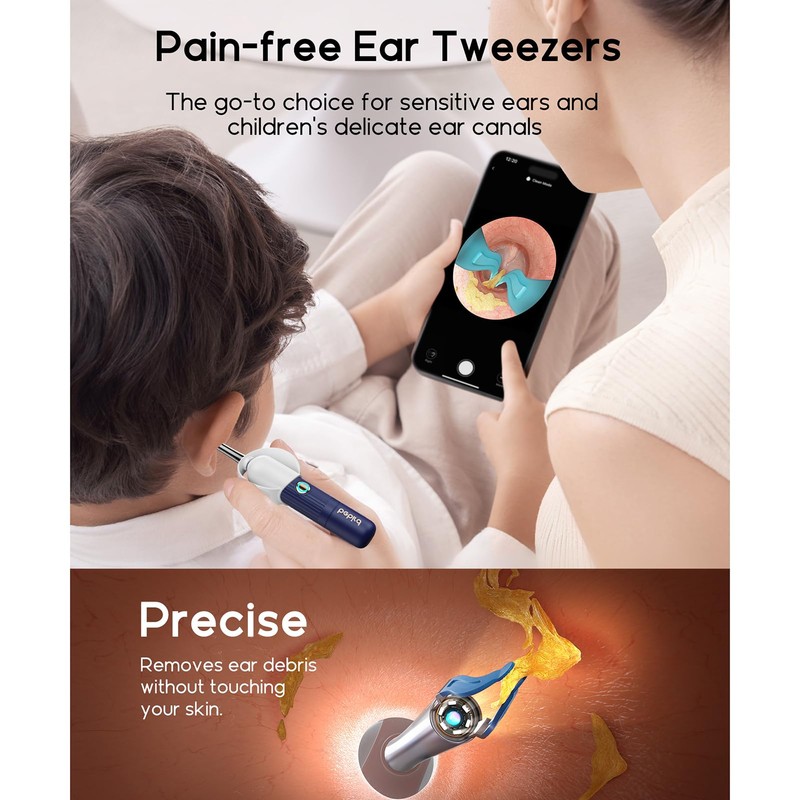 Ear Wax Remover Otoscope for Adults, Children and Pets