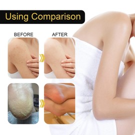 Rose Oil for Face with Ros/e Petal Flower,Rosehip Oil Organic with Vitamin E Oil for Anti-Aging,Rosehip Oil Organic Cold Pressed,Ro/se Essential O/il for Face and Body,Moisturizing and Firming Oi/l