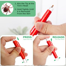 Venprodium 6 Stück Zeckenentferner mit Zeckenzange, Zeckenhaken und Zeckenkarte mit Lupe, Zeckenpinzette, Zeckenentfernung in Sekunden, Alternative Zeckenmittel, Zeckenhebel für Hunde, Katze, Mensch