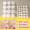 Oval geformte unsichtbare Akne -Pickelflecken, mikronedle Hydrokolloid -Akne -Pickelflecken, Akne