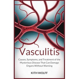 Vasculitis: Causes, Symptoms, and Treatment of the Mysterious Disease That Can Damage Organs Without Warning