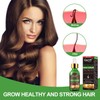 Anti-Hair Loss, Hair Growth Serum, Hair Loss and Hair Treatment,