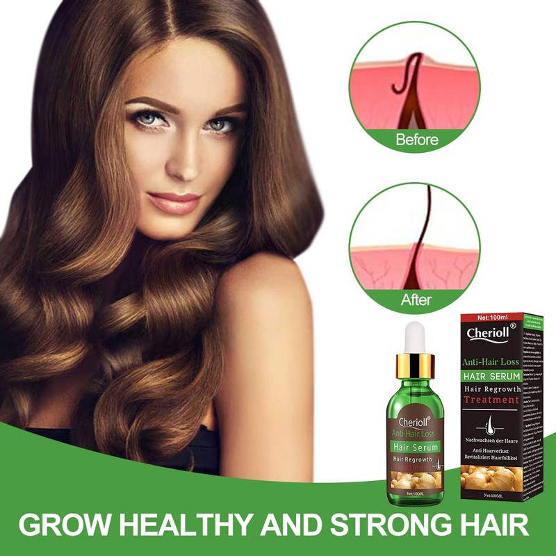 Anti-Hair Loss, Hair Growth Serum, Hair Loss and Hair Treatment,