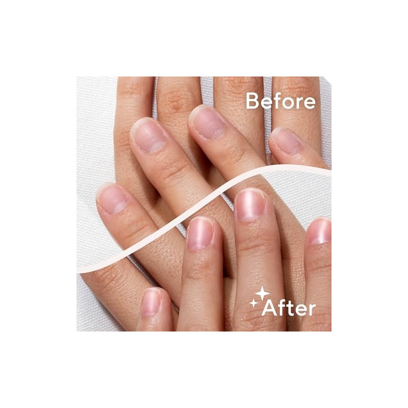 Finishing Touch Flawless Salon Nails Kit, Electronic Nail File and