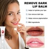 XIRUJNFD Jinshane Lip Serum, Remove Dark Lips Pink Fresh Lightening