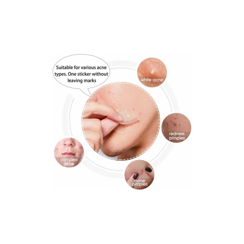 Elaimei Acne Patch Parche Antiacné Rostro Hipoalergénico Vegano T Todo