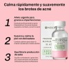 Weud Loción Seca Tratamiento Acné Espinillas Salicílico 29ml
