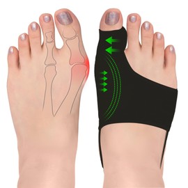 2PCS Bunion Correctors for Women & Men, Adjustable Toe Spacer Bunion Splint, Non-Surgical Hallux Valgus Relief, Breathable Day & Night Support (Black, Large)
