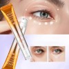 Crema Contorno De Ojos Con Retinol Antiarrugas Roll On 20g