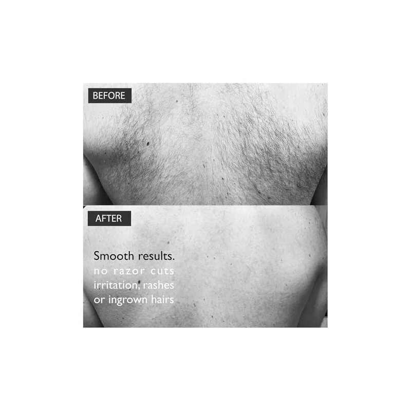 BALDAPE PARLOUR Body & Back Hair Removal Kit with Men's