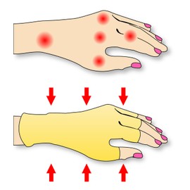 THERAPY GLOVES - 1 PAIR - INTHERMAX©