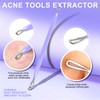 Teenitor Pimple Extractor Acne Treatment Tool Blackhead Comedone Removal 2-in-1