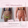 Monnaskin MESOLIPO PPC Cream Monnaskin 50g