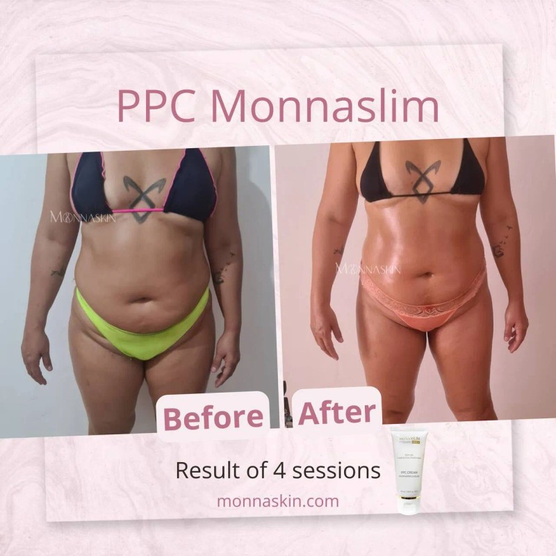 Monnaskin MESOLIPO PPC Cream Monnaskin 50g