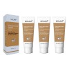 - 3*crema Blanqueadora Piel, Crema Aclaradora For Íntimos