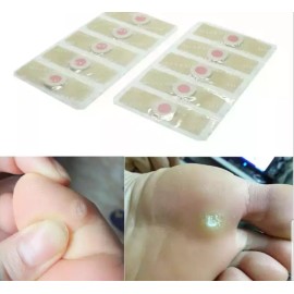 Camimi  42  Curitas Para Eliminar Los Callos Y Verrugas En Los Pies