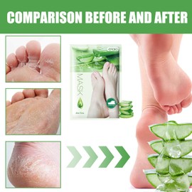 2 Paar Fußmaske, Hornhaut Socken, Fussmaske Feuchtigkeitsspendende, Abgestorbene und Entfernt Effektiv, Fußpflege für Zarte Füße, zur Repariert Raue Fersen für Männer und Frauen Aloen